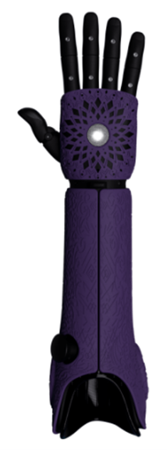Bionic arm