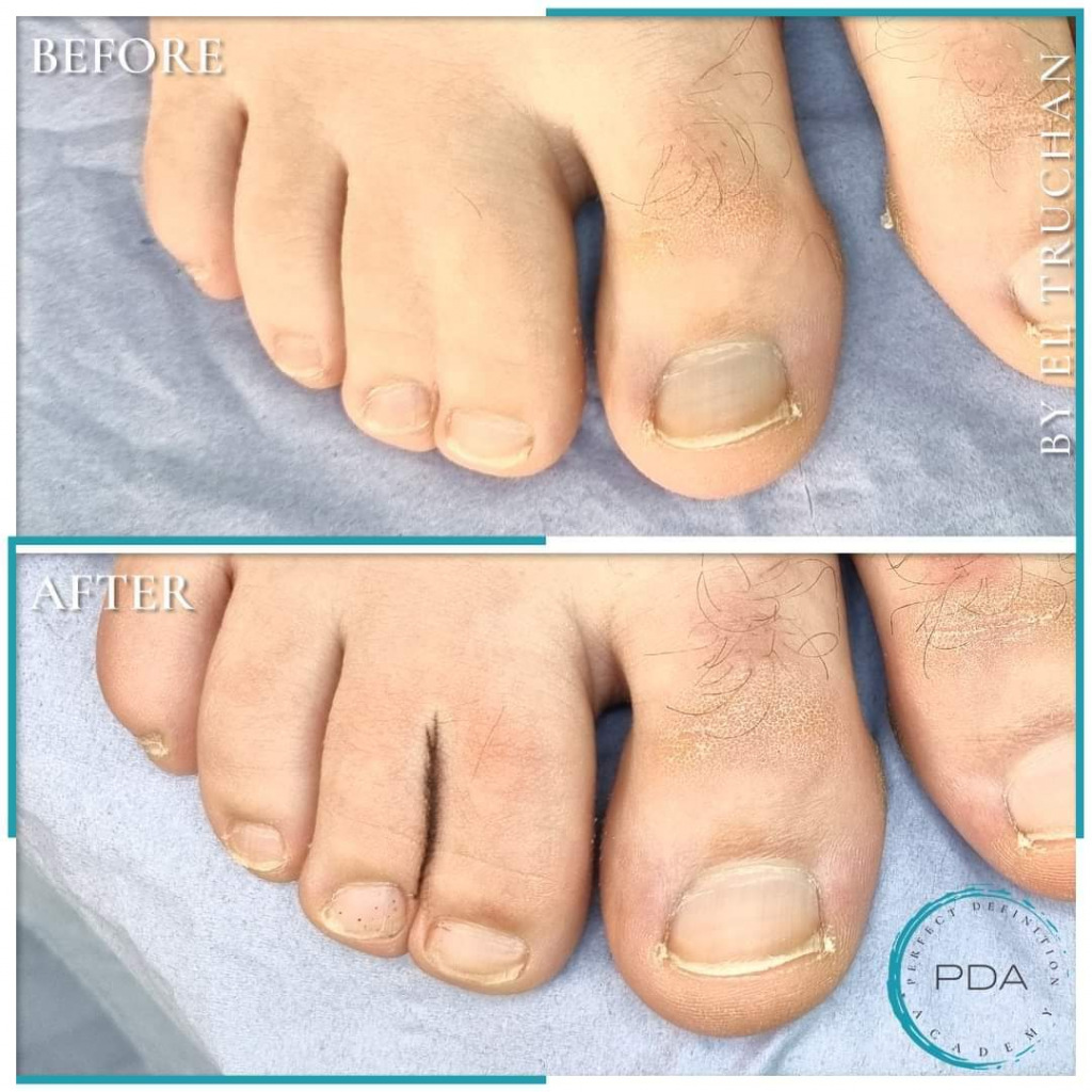 Webbed toes makeup