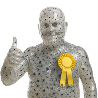 Man whose skin looks like frogspawn